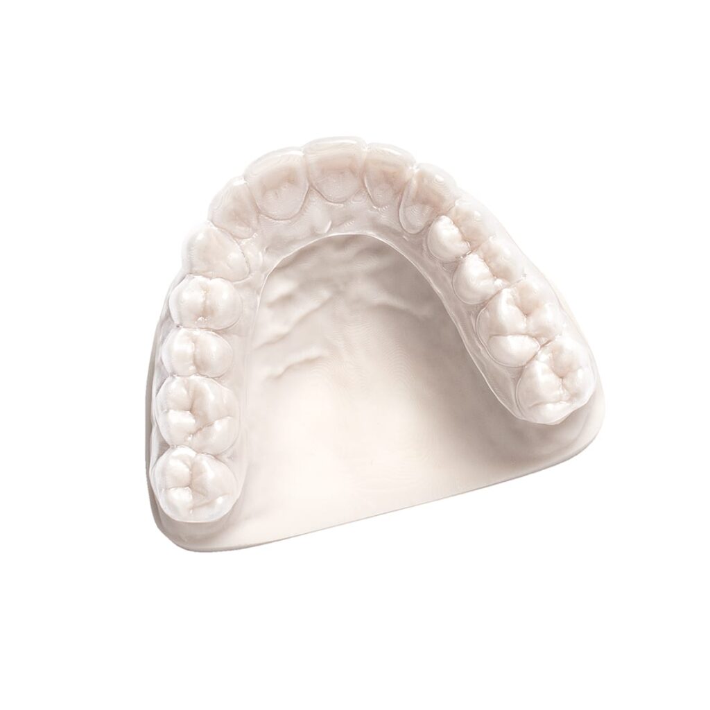 Dental aligner mass customization part Dental aligner mass customization