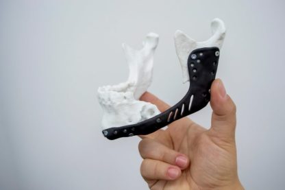 Hand holding 3D printed jaw